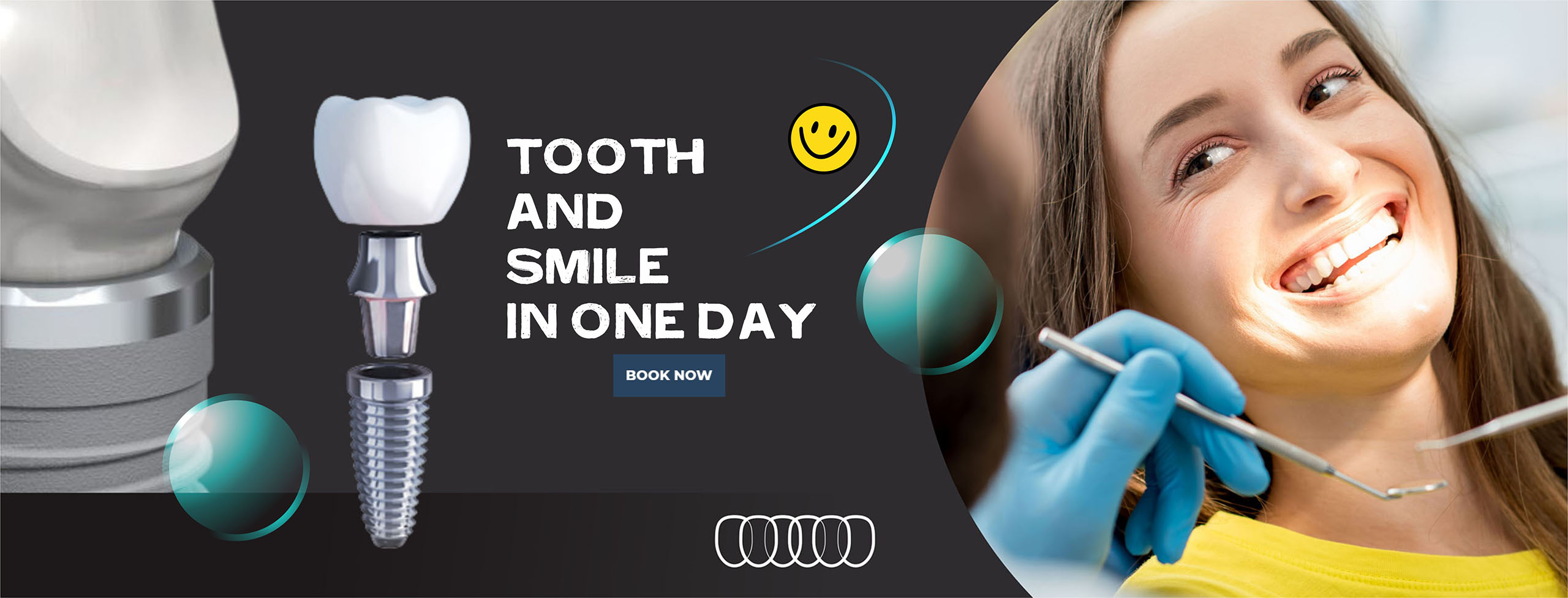 Dr. Daniel Kao dental implant treatment