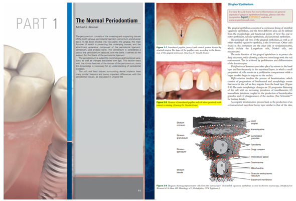 Carranza’s Clinical Periodontology : Perio Chapter