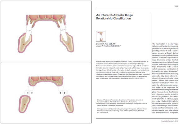 The Inter-Arch Alveolar Ridge Classification
