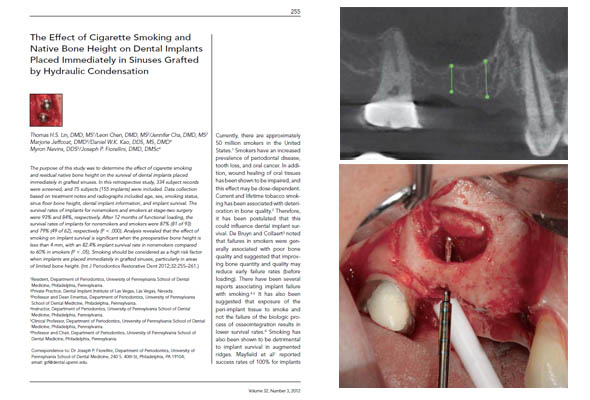 Tissue Engineering Apporach for Dental Implant Surgery